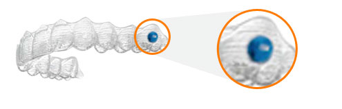 Aligner